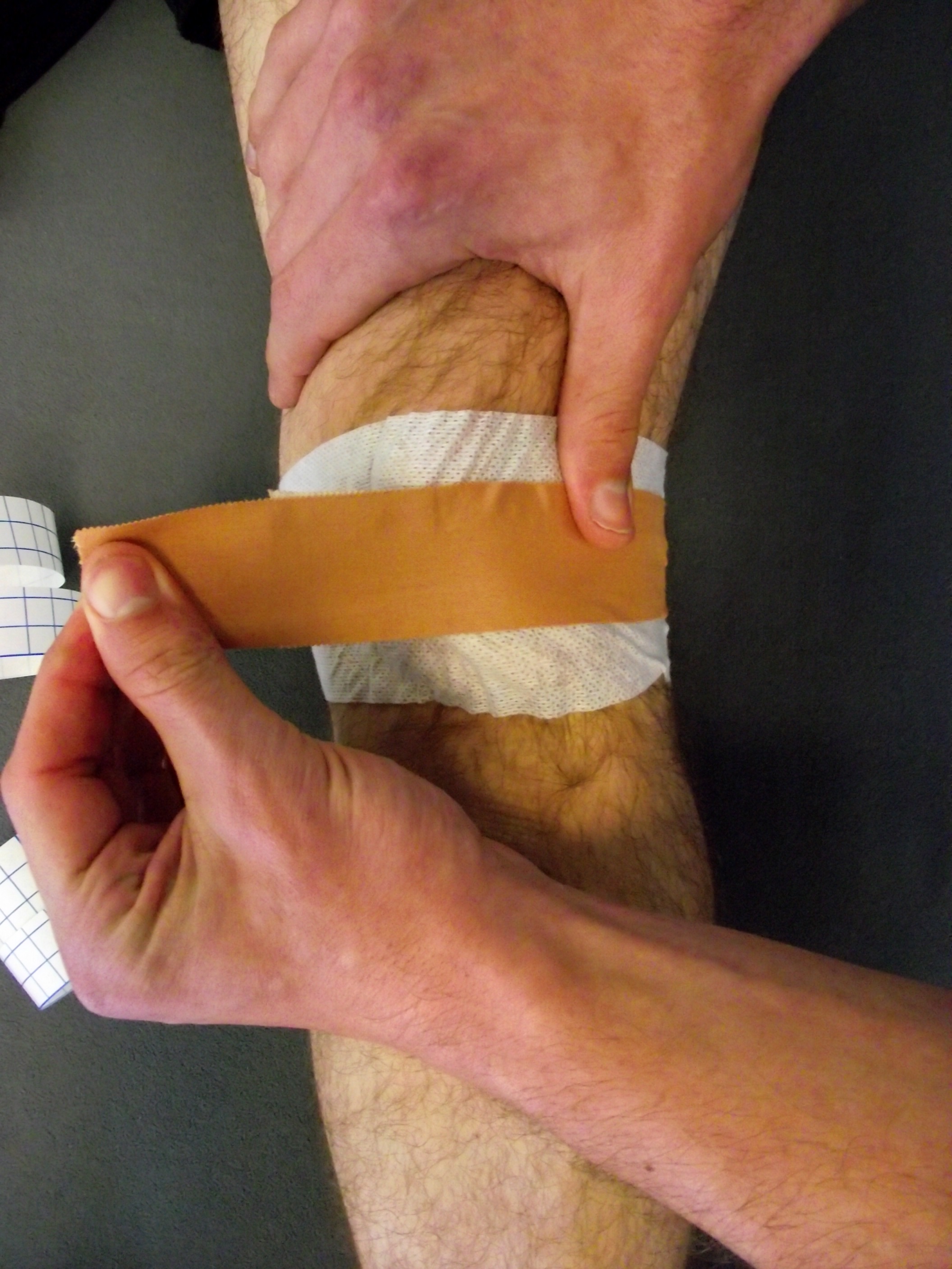 Medial patella tape