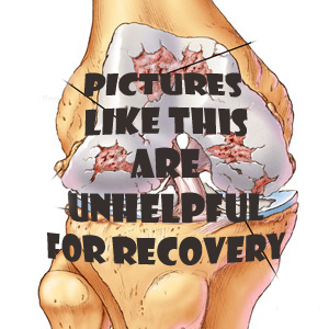 knee-arthritis658 copy